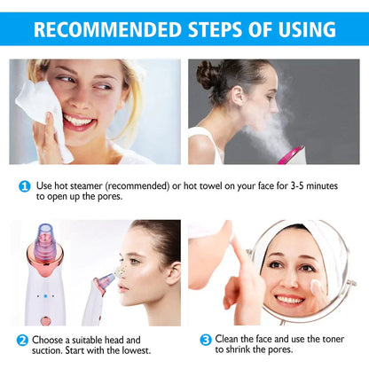 Electric Suction Blackhead Remover